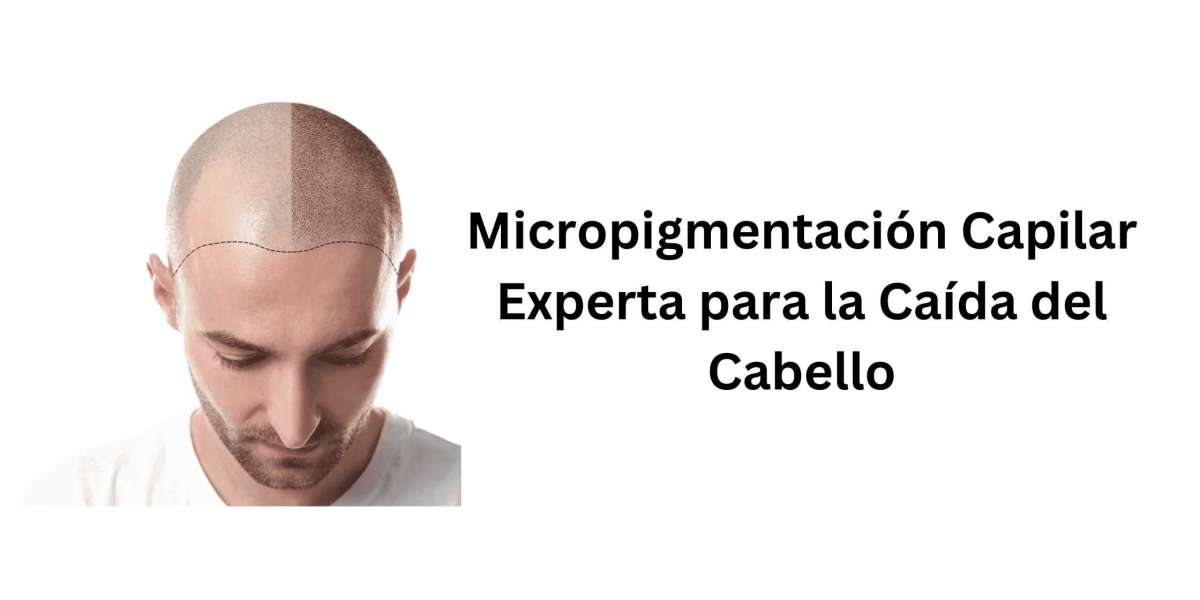 Micropigmentación Capilar Experta para la Caída del Cabello