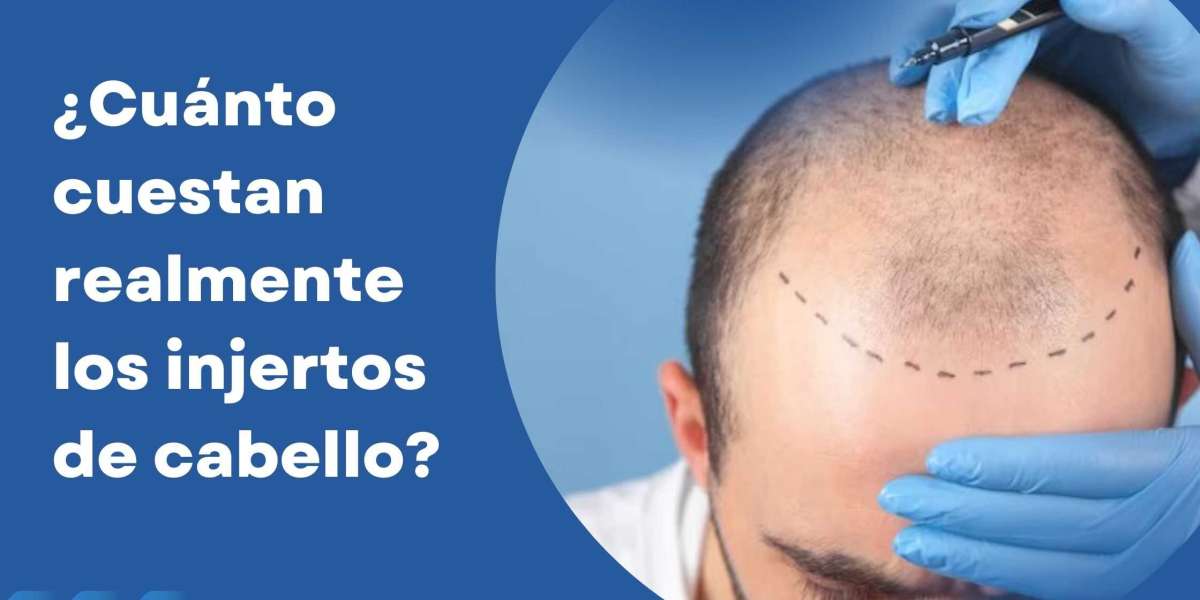 ¿Cuánto cuestan realmente los injertos de cabello?