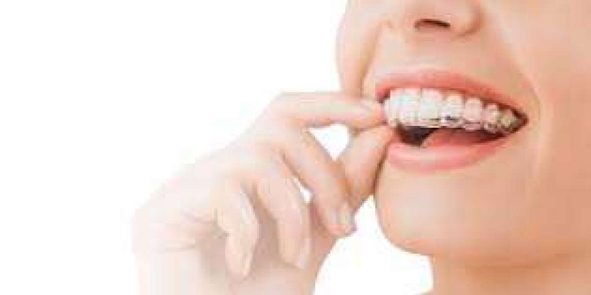 UK's Leading Dentists for Composite Bonding and Invisalign Treatment