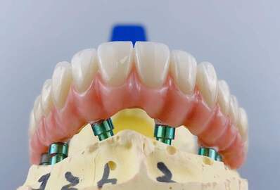 Dental Implant Manufacturer China | Custom Implants & Precision Solutions | Mega Dental Lab