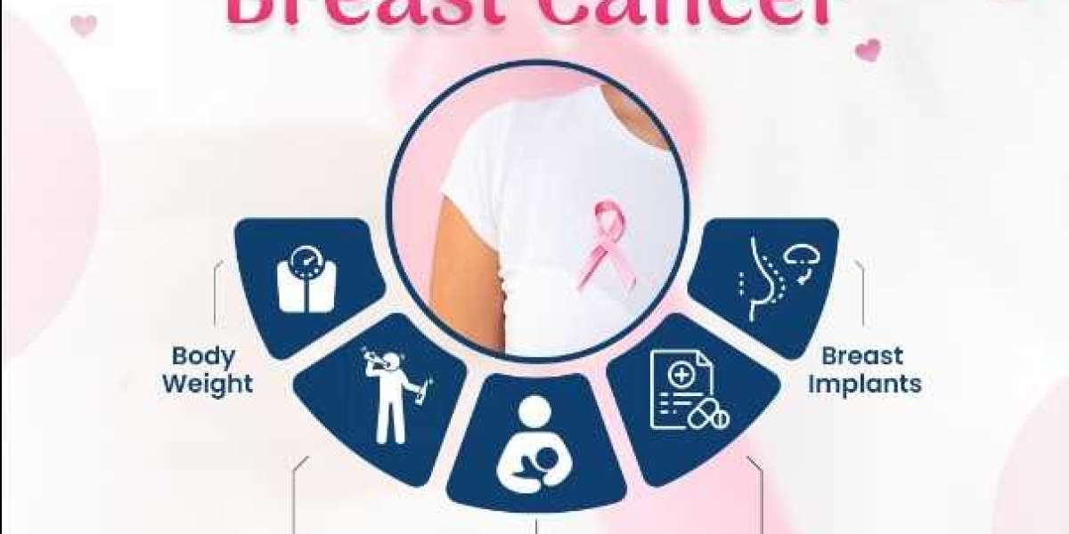 Best Breast Cancer Specialist in Delhi NCR