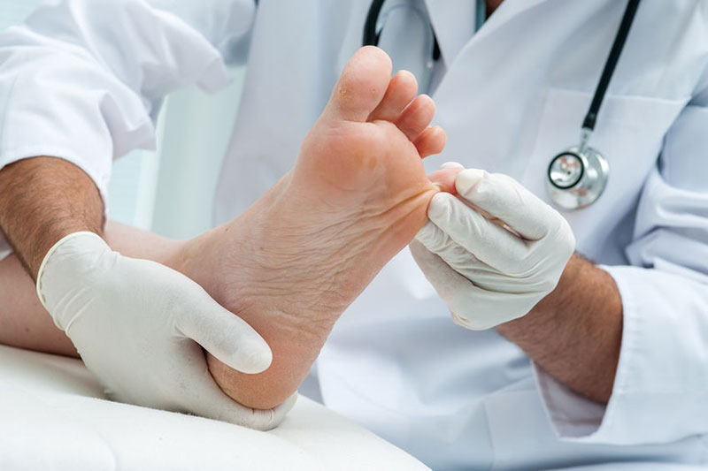 Diabetic Foot Doctors, Diabetic Foot Treatment | WDC